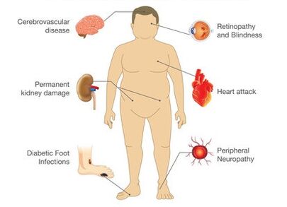 Gluconol previne complicațiile